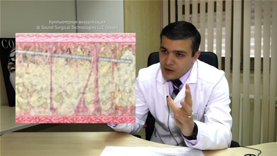 Интервью с Рахимовым А.Я.: Липоскульптура в Центре реконструктивно-пластической хирургии