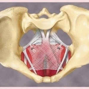 Сетчатый протез для коррекции апикального пролапса гениталий "Элевейт задний"